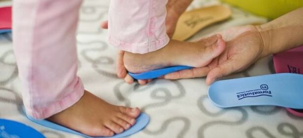 Soles with valgus deformation of the foot in children