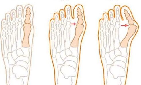 Development of the foot