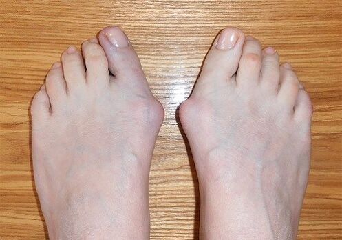 Invoices on the feet
